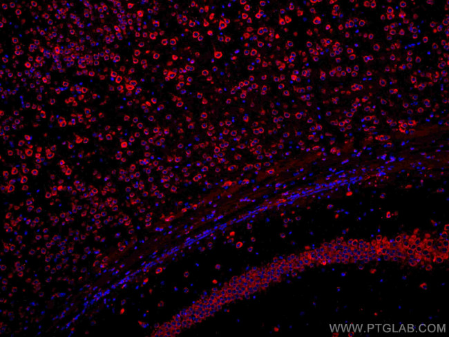 YTHDF1 Antibody in Immunohistochemistry (Paraffin) (IHC (P))