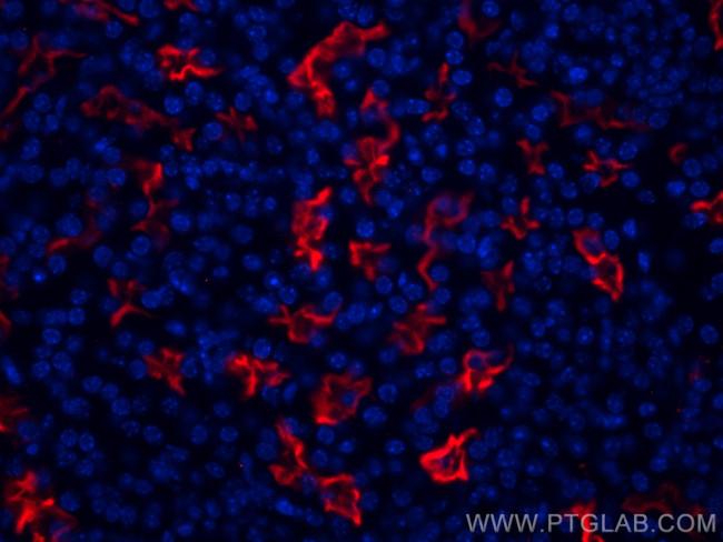 ACE2 Antibody in Immunohistochemistry (Paraffin) (IHC (P))