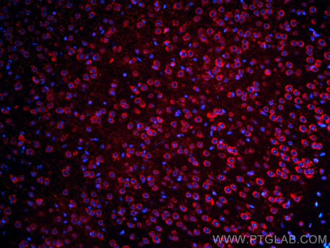 S1PR2 Antibody in Immunohistochemistry (Paraffin) (IHC (P))