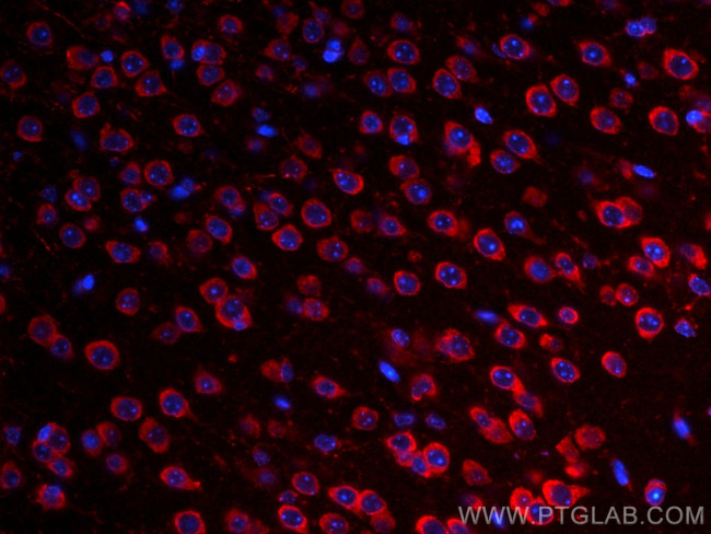 S1PR2 Antibody in Immunohistochemistry (Paraffin) (IHC (P))