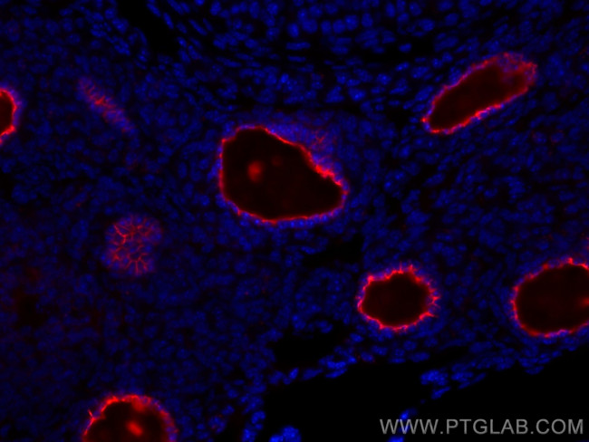 ZP3 Antibody in Immunohistochemistry (Paraffin) (IHC (P))