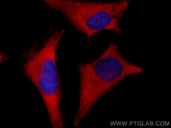 ROCK1 Antibody in Immunocytochemistry (ICC/IF)