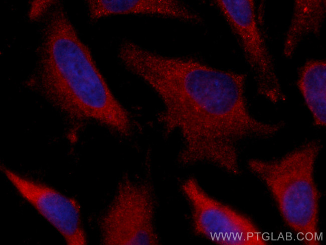 USP9X Antibody in Immunocytochemistry (ICC/IF)