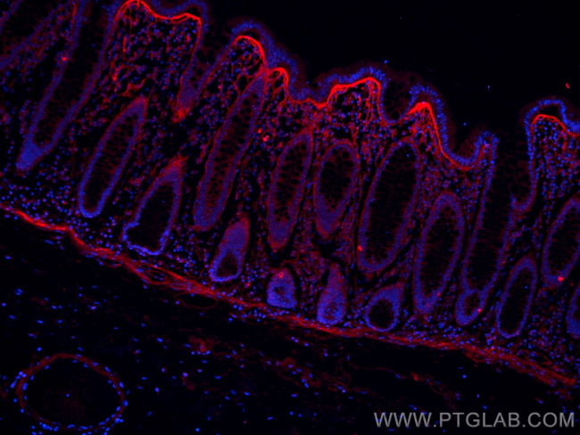 TGFBI/BIGH3 Antibody in Immunohistochemistry (Paraffin) (IHC (P))