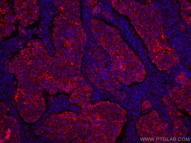 LGALS3BP Antibody in Immunohistochemistry (Paraffin) (IHC (P))