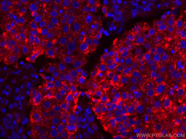 LGALS3BP Antibody in Immunohistochemistry (Paraffin) (IHC (P))