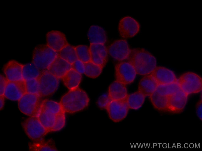 IFITM1 Antibody in Immunocytochemistry (ICC/IF)