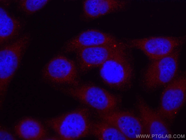 Septin 2 Antibody in Immunocytochemistry (ICC/IF)