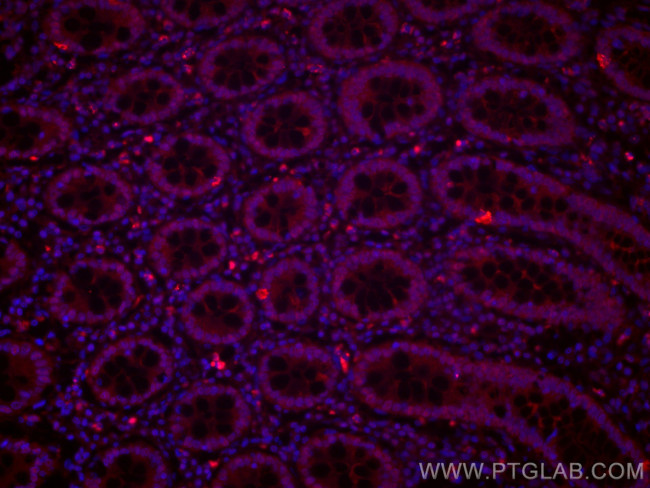 PPAR gamma Antibody in Immunohistochemistry (Paraffin) (IHC (P))