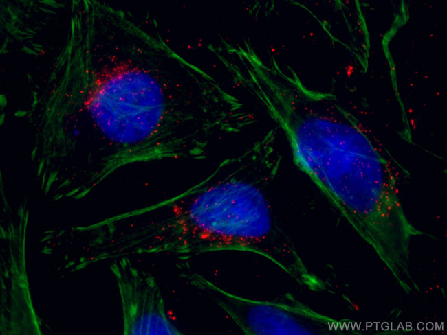 ABCD1 Antibody in Immunocytochemistry (ICC/IF)