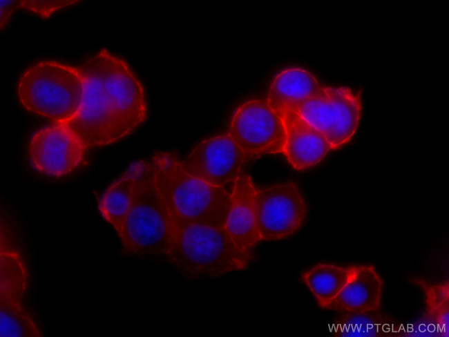 SNAP25 Antibody in Immunocytochemistry (ICC/IF)