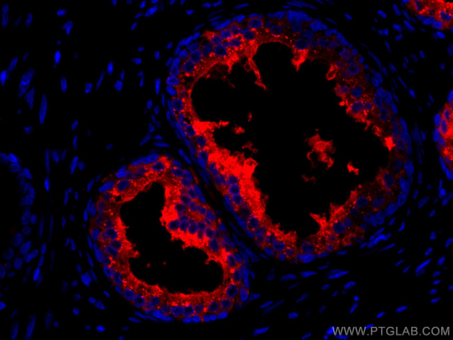 ACPP Antibody in Immunohistochemistry (Paraffin) (IHC (P))