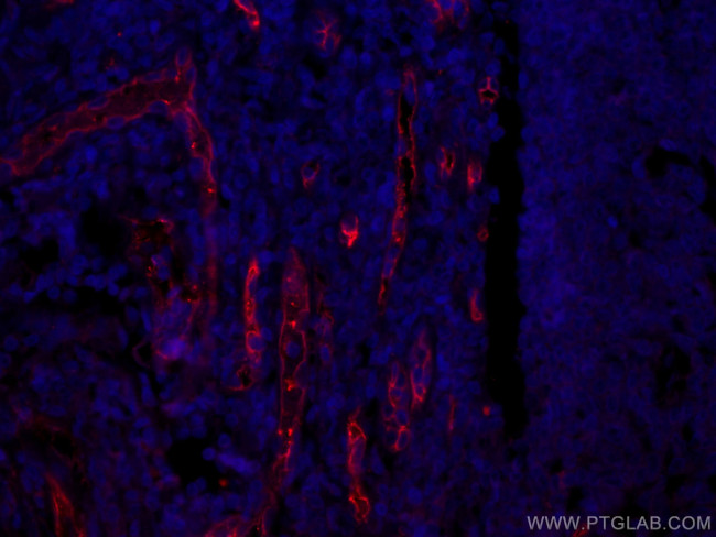 CD34 Antibody in Immunohistochemistry (Paraffin) (IHC (P))