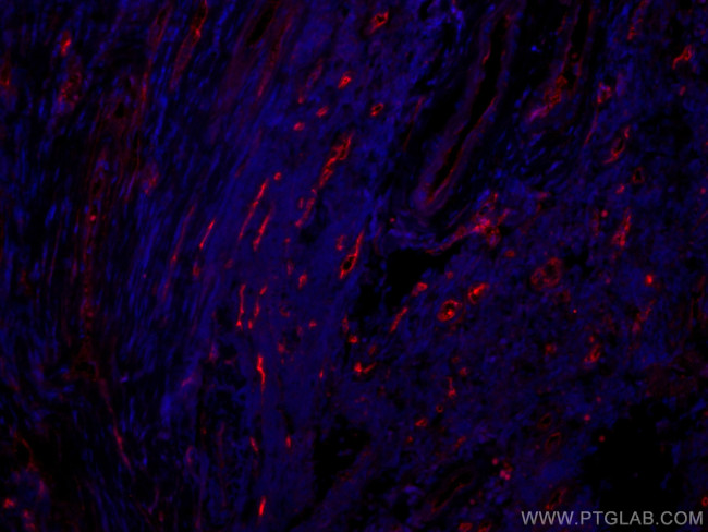 CD34 Antibody in Immunohistochemistry (Paraffin) (IHC (P))