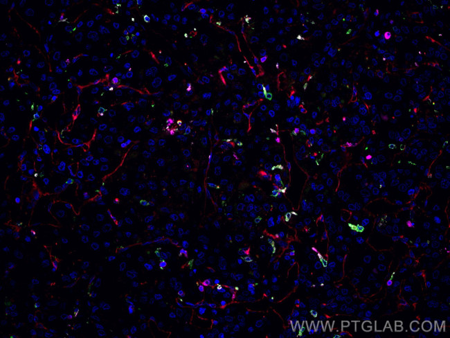 CD34 Antibody in Immunohistochemistry (Paraffin) (IHC (P))