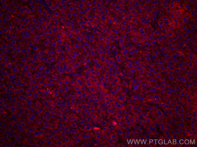 TNFR1 Antibody in Immunohistochemistry (Paraffin) (IHC (P))