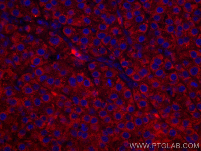 TNFR1 Antibody in Immunohistochemistry (Paraffin) (IHC (P))