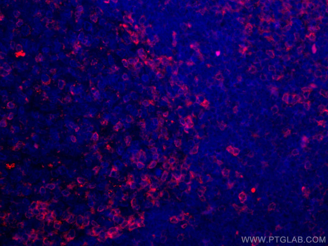 ZAP70 Antibody in Immunohistochemistry (Paraffin) (IHC (P))