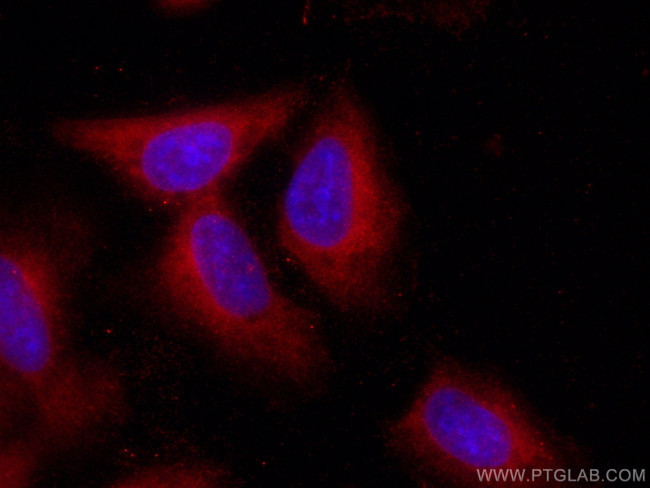 Galectin-1 Antibody in Immunocytochemistry (ICC/IF)