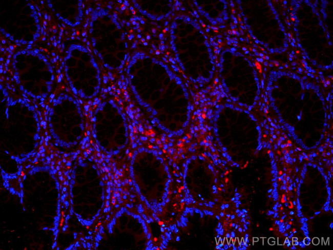 Galectin-1 Antibody in Immunohistochemistry (Paraffin) (IHC (P))