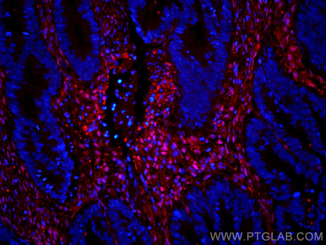 Galectin-1 Antibody in Immunohistochemistry (Paraffin) (IHC (P))