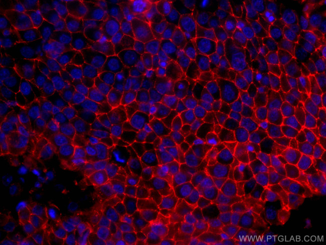 CD9 Antibody in Immunohistochemistry (Paraffin) (IHC (P))