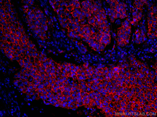 CD9 Antibody in Immunohistochemistry (Paraffin) (IHC (P))