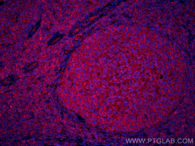 IL-28A Antibody in Immunohistochemistry (Paraffin) (IHC (P))