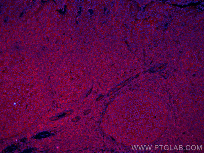 IL-28A Antibody in Immunohistochemistry (Paraffin) (IHC (P))