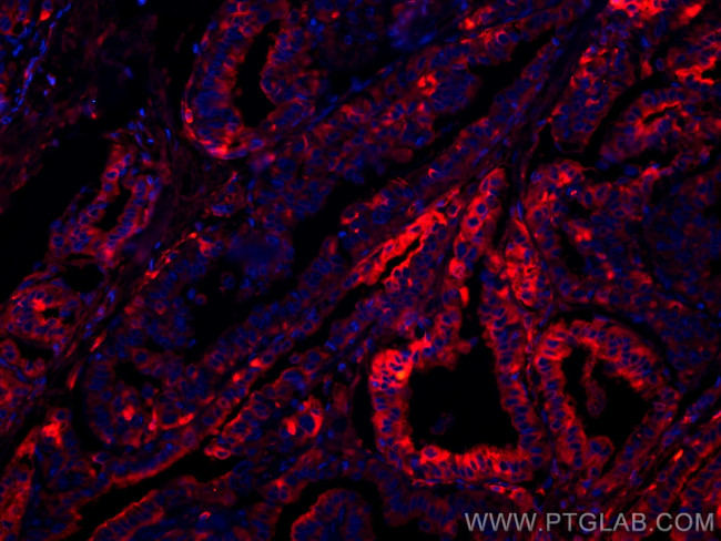 Thyroglobulin Antibody in Immunohistochemistry (Paraffin) (IHC (P))