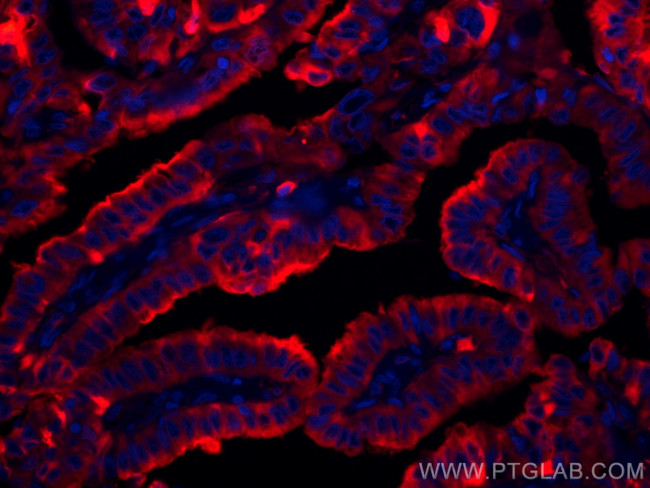 Thyroglobulin Antibody in Immunohistochemistry (Paraffin) (IHC (P))