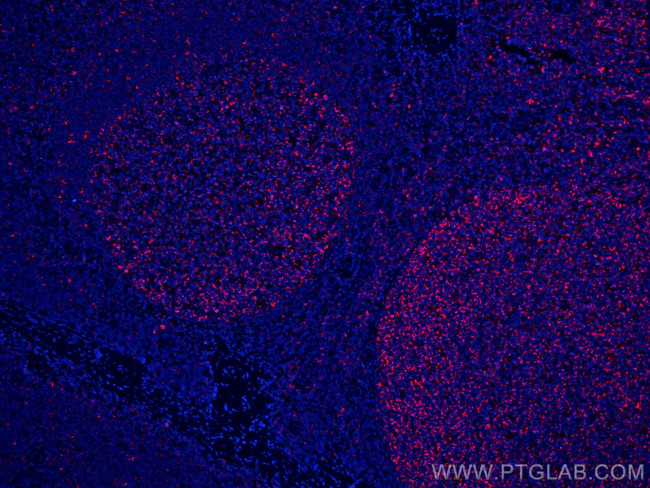 IL-19 Antibody in Immunohistochemistry (Paraffin) (IHC (P))