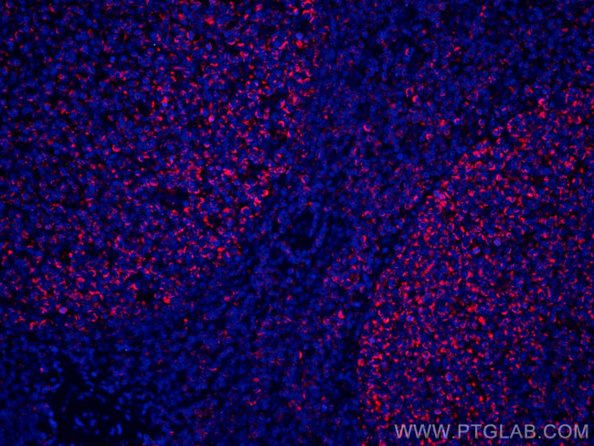 IL-19 Antibody in Immunohistochemistry (Paraffin) (IHC (P))