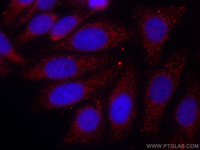 ATP5C1 Antibody in Immunocytochemistry (ICC/IF)