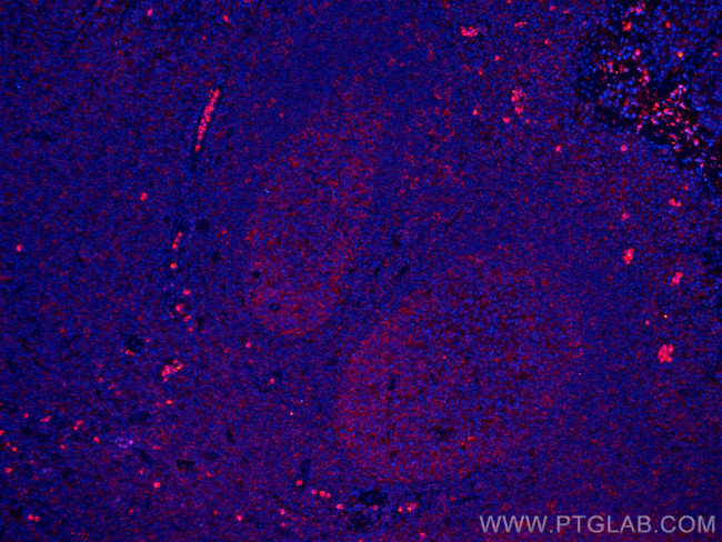 IL-36 Beta/IL-1F8 Antibody in Immunohistochemistry (Paraffin) (IHC (P))