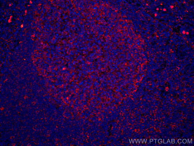 IL-36 Beta/IL-1F8 Antibody in Immunohistochemistry (Paraffin) (IHC (P))