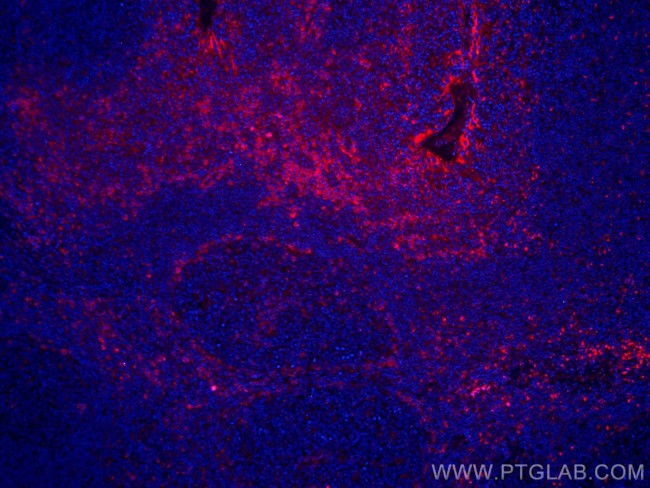 IL-2 Antibody in Immunohistochemistry (Paraffin) (IHC (P))