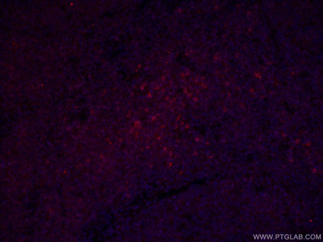 CD3 gamma Antibody in Immunohistochemistry (Paraffin) (IHC (P))