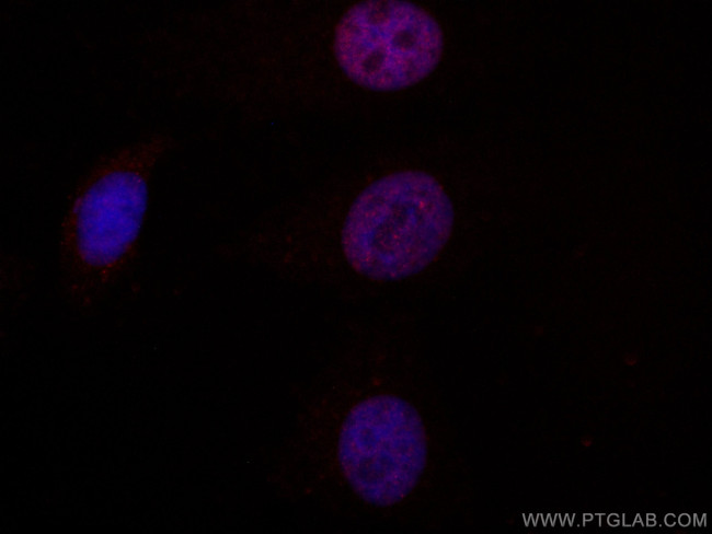 MUM1 Antibody in Immunocytochemistry (ICC/IF)