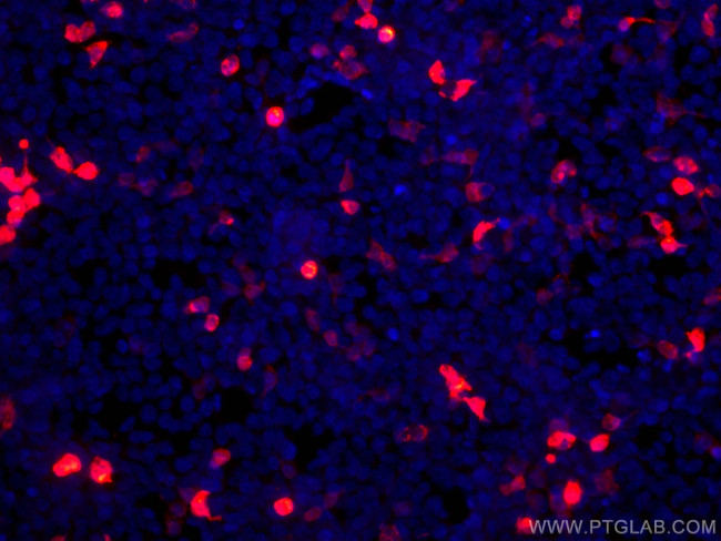 GFP tag Antibody in Immunocytochemistry (ICC/IF)