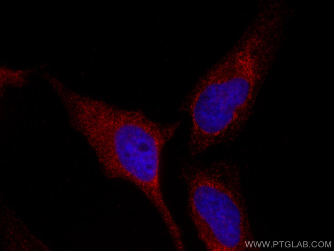 MCL1 Antibody in Immunocytochemistry (ICC/IF)