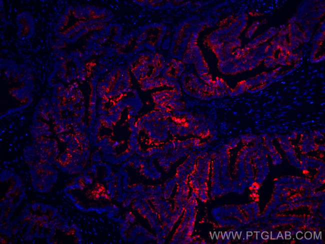 Protein C inhibitor Antibody in Immunohistochemistry (Paraffin) (IHC (P))