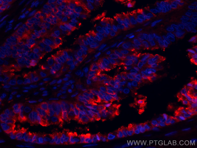 Protein C inhibitor Antibody in Immunohistochemistry (Paraffin) (IHC (P))