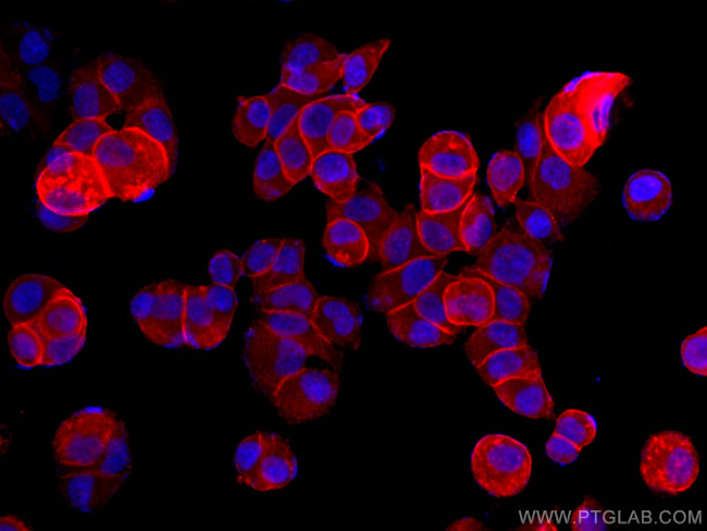 Annexin A2 Antibody in Immunocytochemistry (ICC/IF)