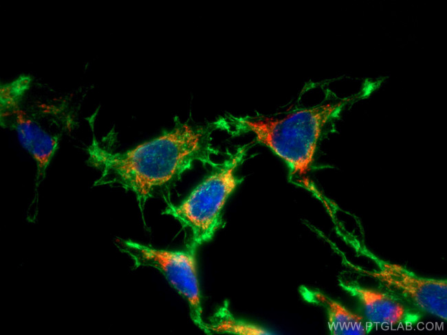 LONP1 Antibody in Immunocytochemistry (ICC/IF)