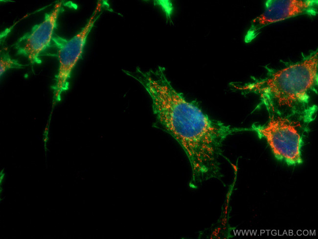 LONP1 Antibody in Immunocytochemistry (ICC/IF)