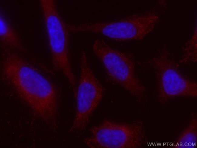 NCALD Antibody in Immunocytochemistry (ICC/IF)