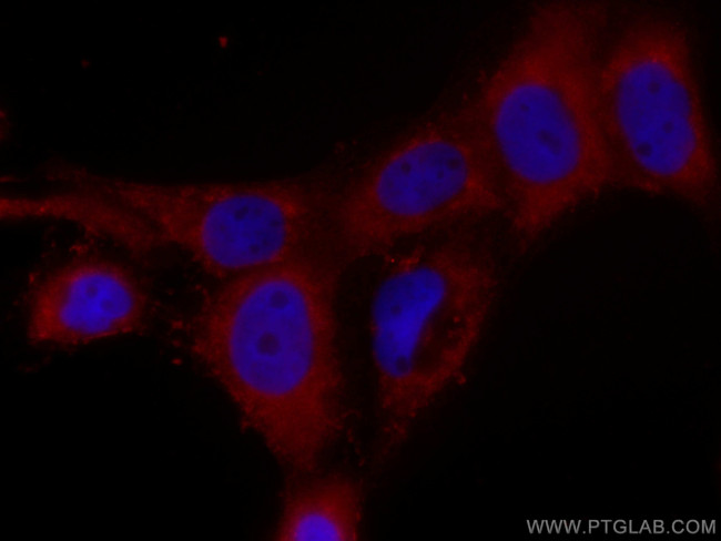 CSK Antibody in Immunocytochemistry (ICC/IF)