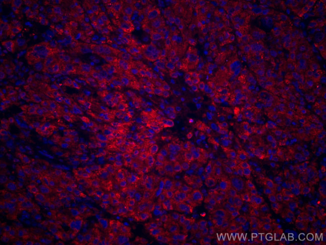 GOSR2/Membrin Antibody in Immunohistochemistry (Paraffin) (IHC (P))