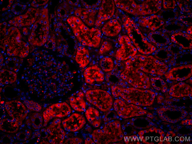 BBS5 Antibody in Immunohistochemistry (Paraffin) (IHC (P))